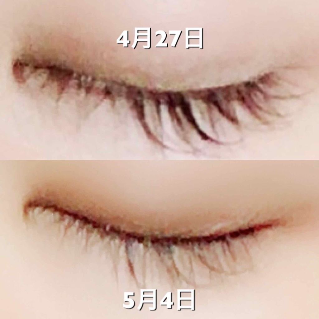 リバイタラッシュ アドバンス ジャパン/エム・アール・アイ/まつげ美容液を使ったクチコミ(2枚目)