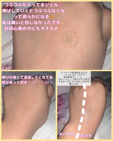 マイクロダーマブースター/XOUL/美容液を使ったクチコミ(2枚目)