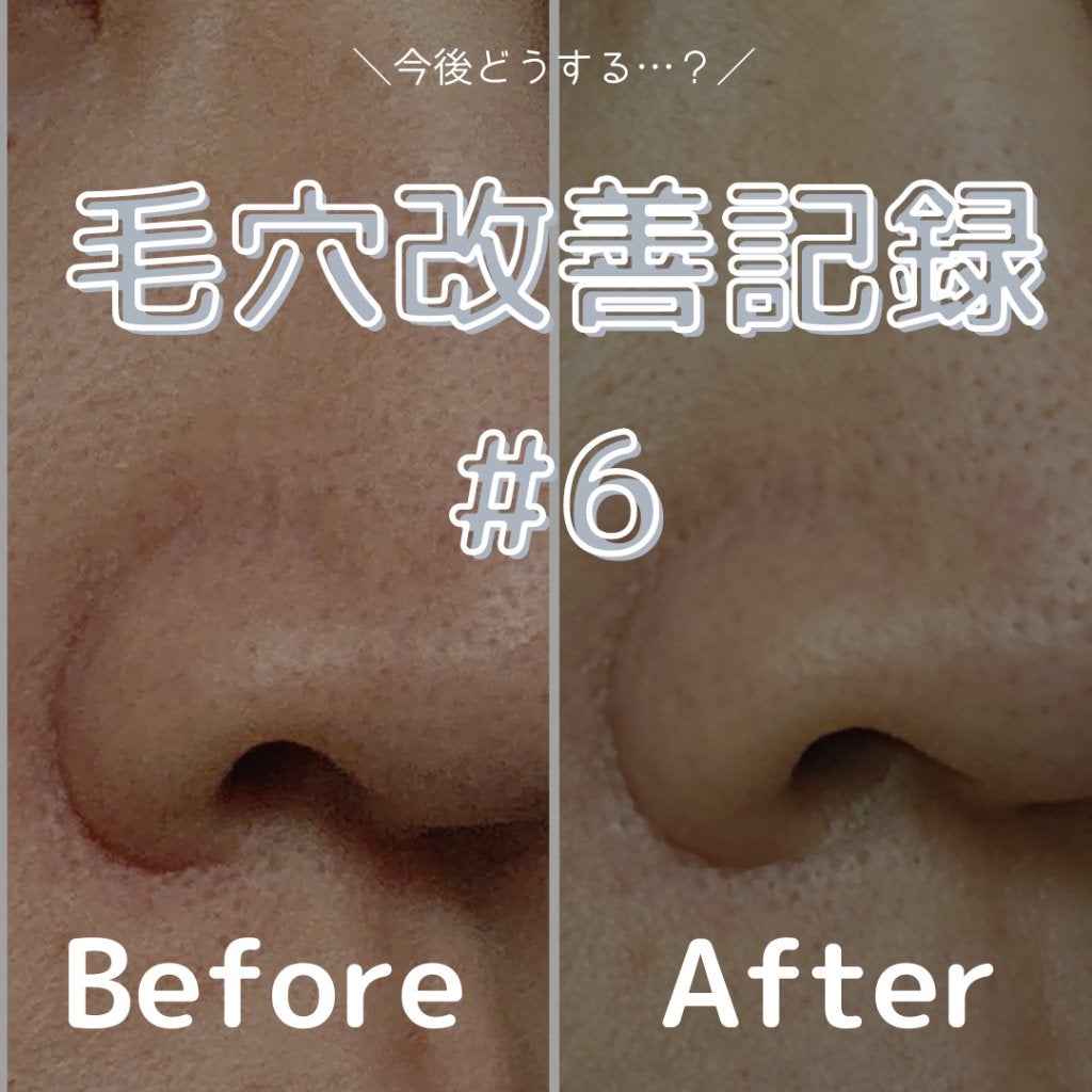 ããã ã®åç²§æ°Ž(ããã¥ãªãš ã¹ãã³ã³ã³ãã£ã·ã§ã㌠R )/ããã¥ãªãš/åç²§æ°Žã䜿ã£ãã¯ãã³ãïŒ1æç®ïŒ