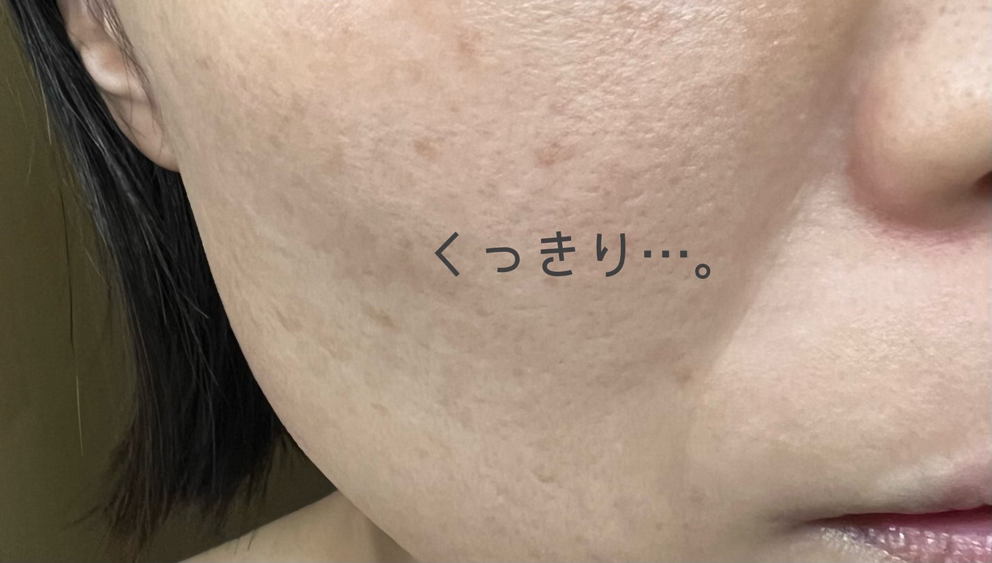 ザ セラム リンクルリペア 朝用 /アスタリフト/美容液を使ったクチコミ(4枚目)