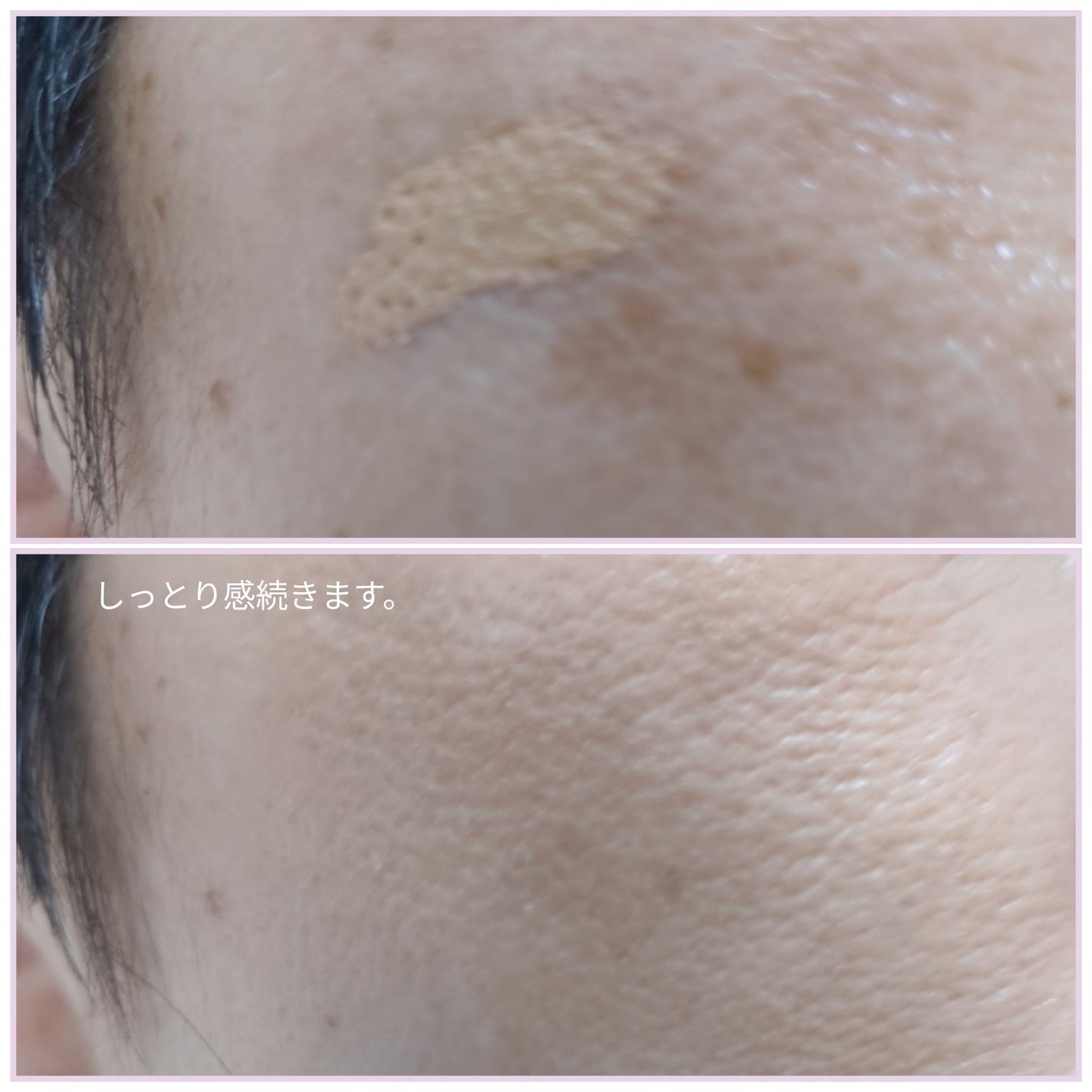 ダーマシンコンシーラー/23years old/リキッドコンシーラーを使ったクチコミ(5枚目)