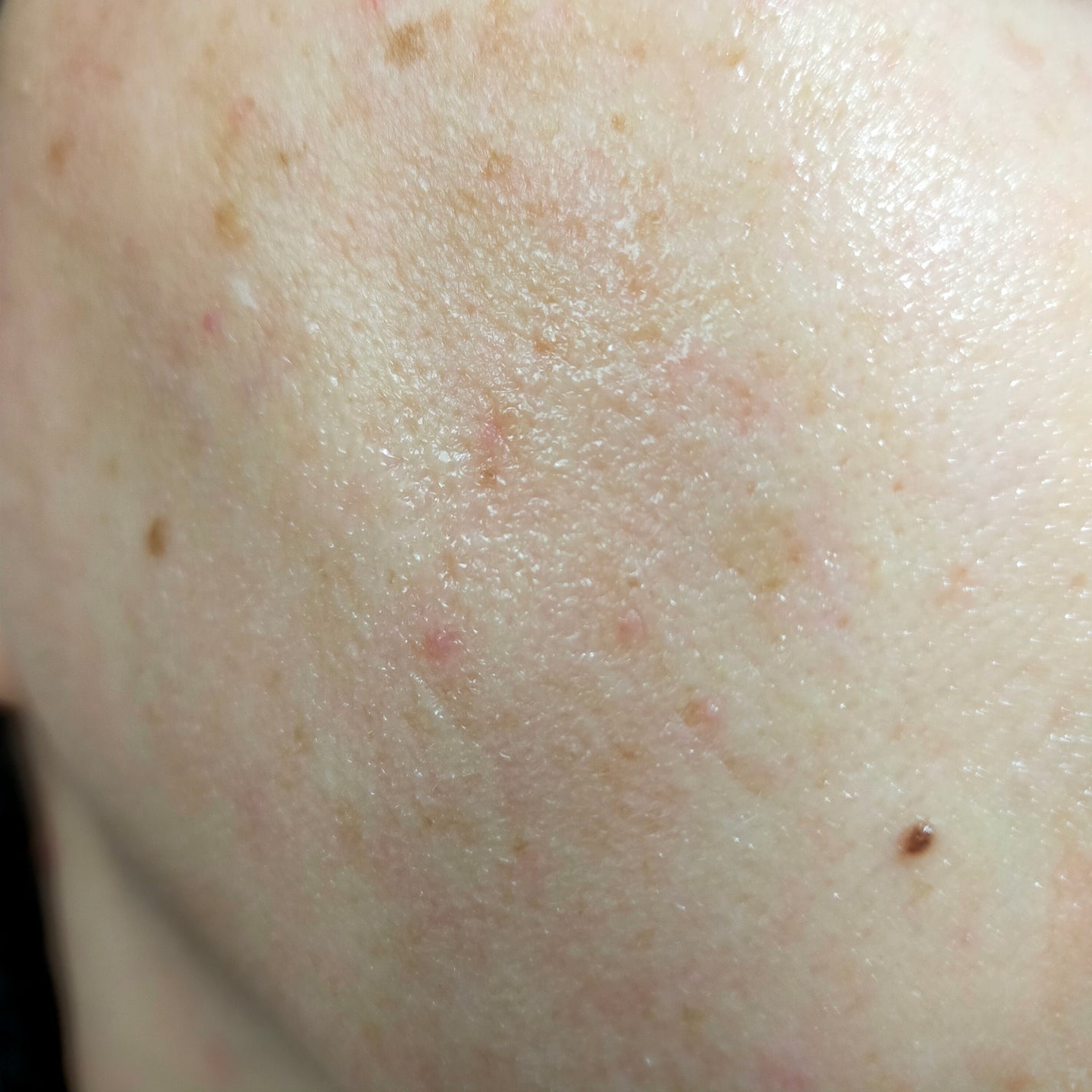 ドクタージー ピュア ビタミンA ファーミングマスク/Dr.G/シートマスク・パックを使ったクチコミ(4枚目)