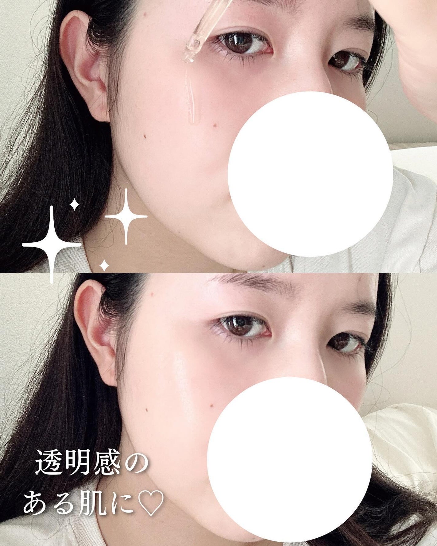 ちゃも on LIPS 「こんにちはちゃもです🐱今回は、ELTビタユースビタミンC抗酸化..」(4枚目)