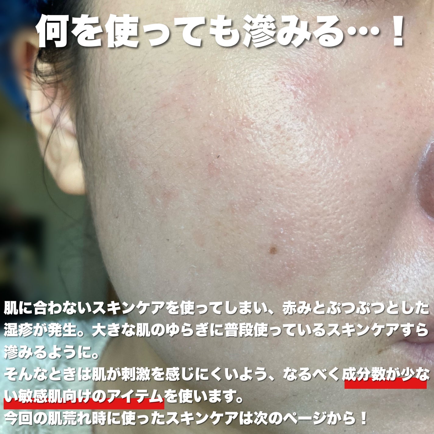 AD コントロール ローション/ACSEINE/化粧水を使ったクチコミ(2枚目)