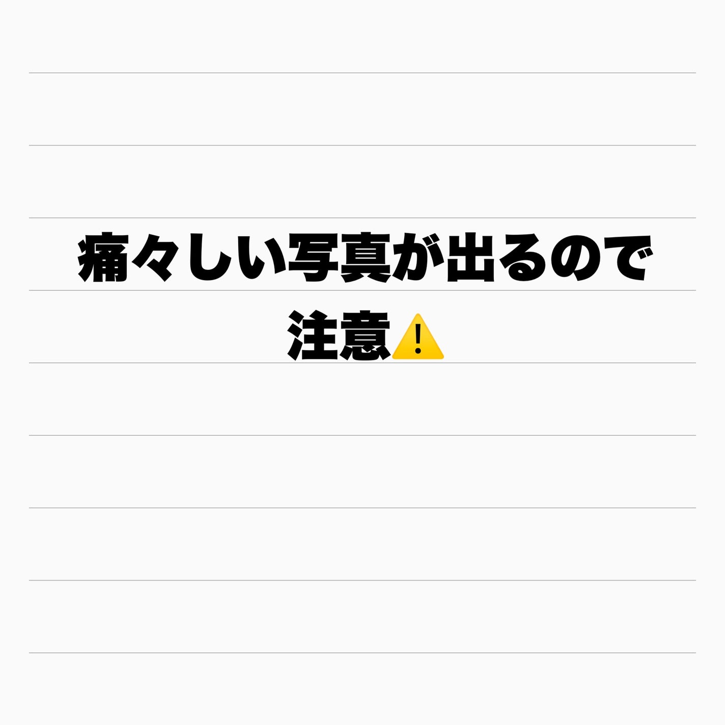 anam on LIPS 「シミ取りレーザーしました!!正直レビュー!先月シミ取りレーザー..」(2枚目)