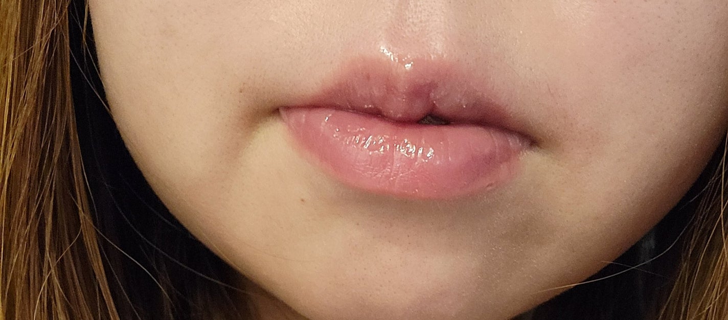 オールマイシングス トゥルービューティ キス リッププランパー/all my things/リッププランパーを使ったクチコミ(1枚目)