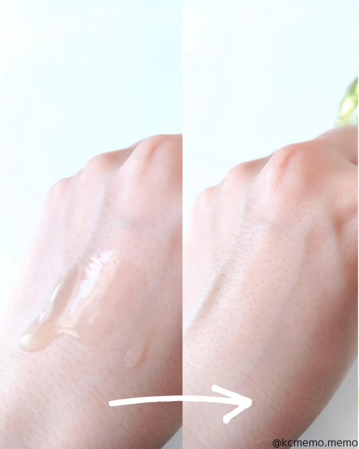 メリタンショットガン/セルオロジー/美顔器・マッサージを使ったクチコミ(10枚目)