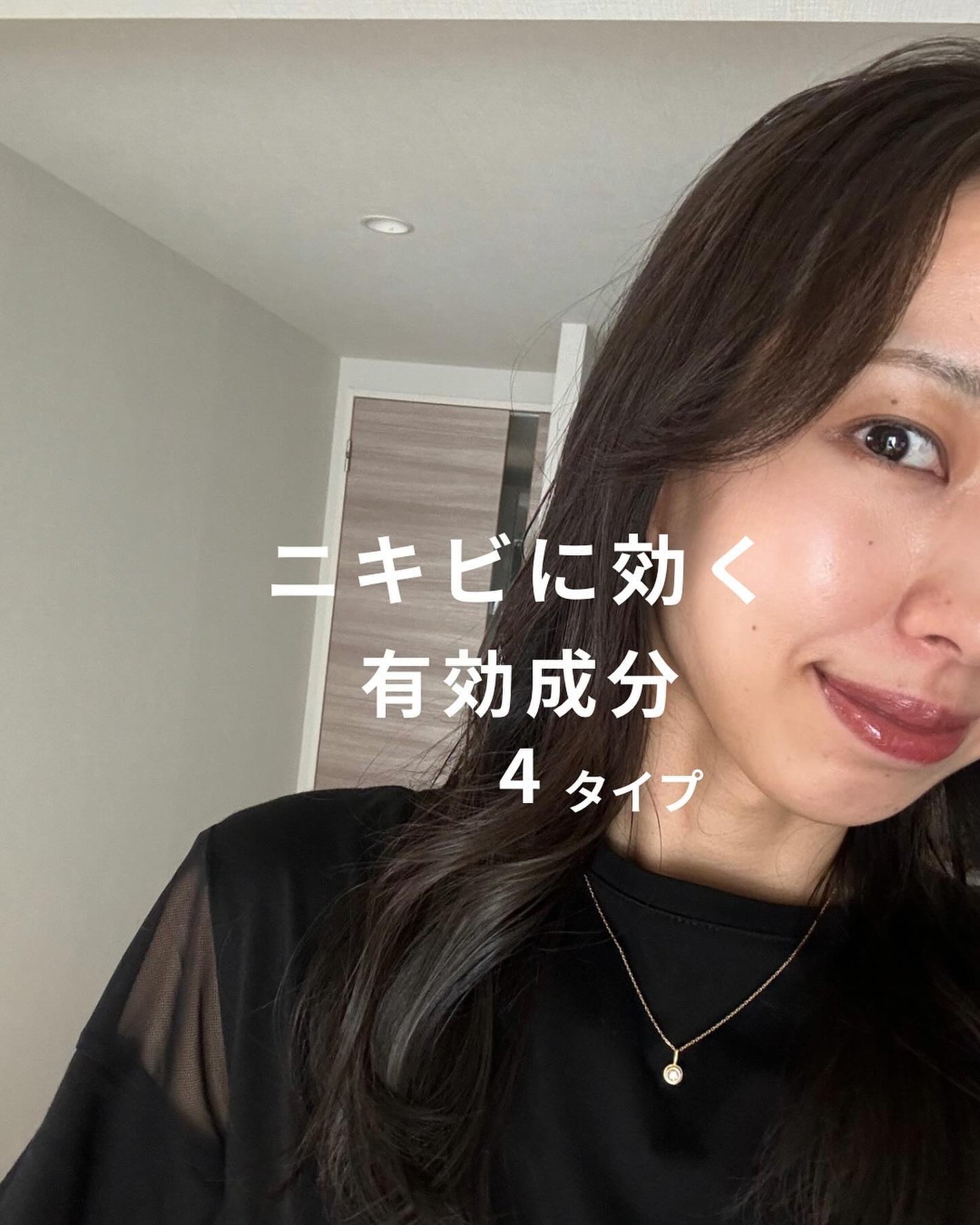 荒川七菜美 on LIPS 「ニキビ肌を卒業する方法🎓→@skin.tamagoどうも、たま..」(1枚目)
