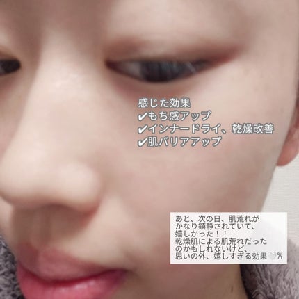 バリアダームデイリーモイストシートマスク/SKIN&LAB/シートマスク・パックを使ったクチコミ(5枚目)