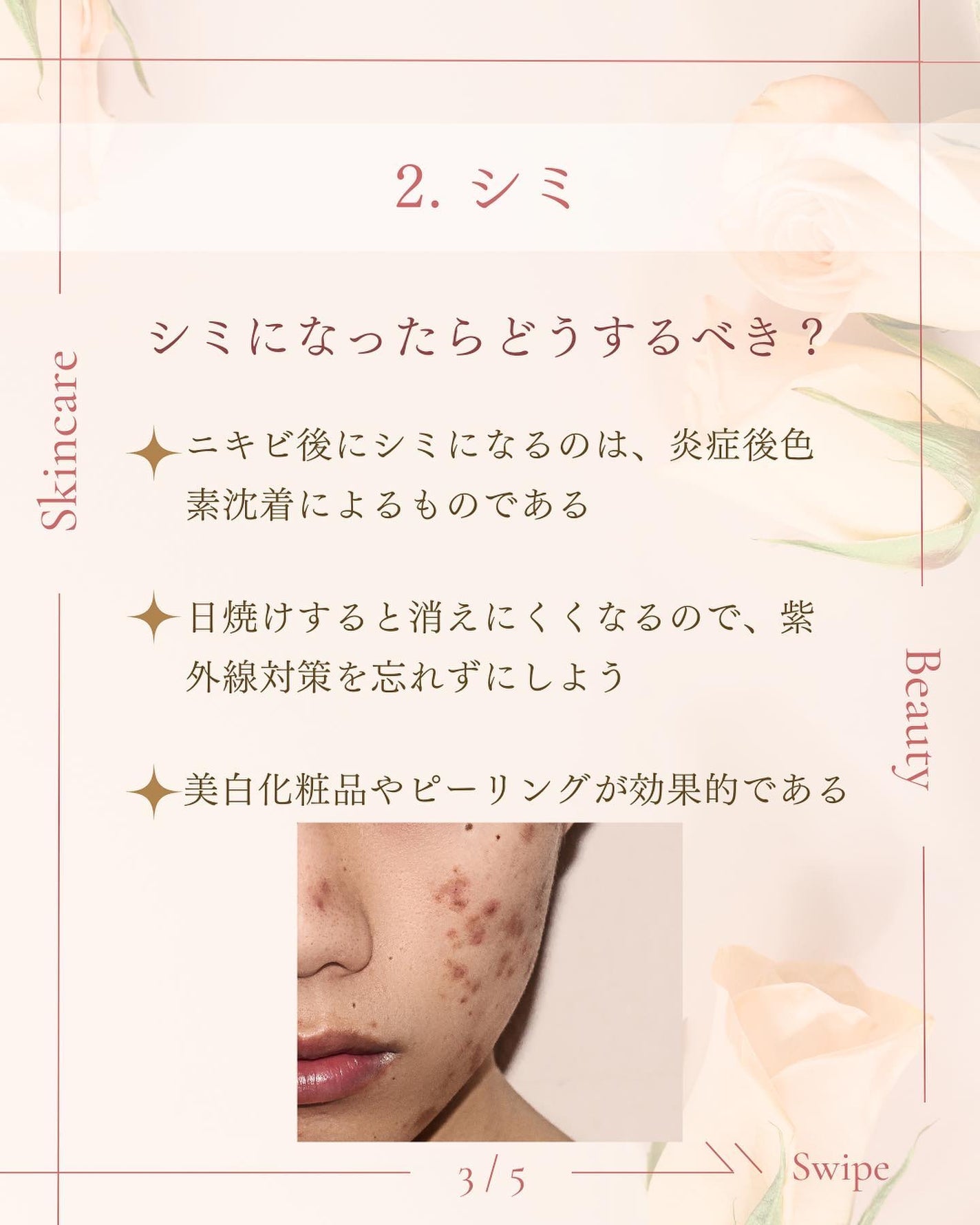 ã¿ãð¹ on LIPS ãæå€ãšç¥ããªã/ãããè·¡ã®ãæå
¥ãæ¹æ³ð¡ãããè·¡ãæ¹åãããã..ãïŒ4æç®ïŒ