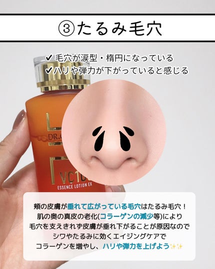 VC100エッセンスローション EX/ドクターシーラボⓇ/化粧水を使ったクチコミ(7枚目)