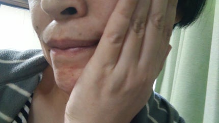 ダルバ ホワイトトリュフファーストスプレーセラム/ダルバ/ミスト状化粧水を使ったクチコミ(5枚目)