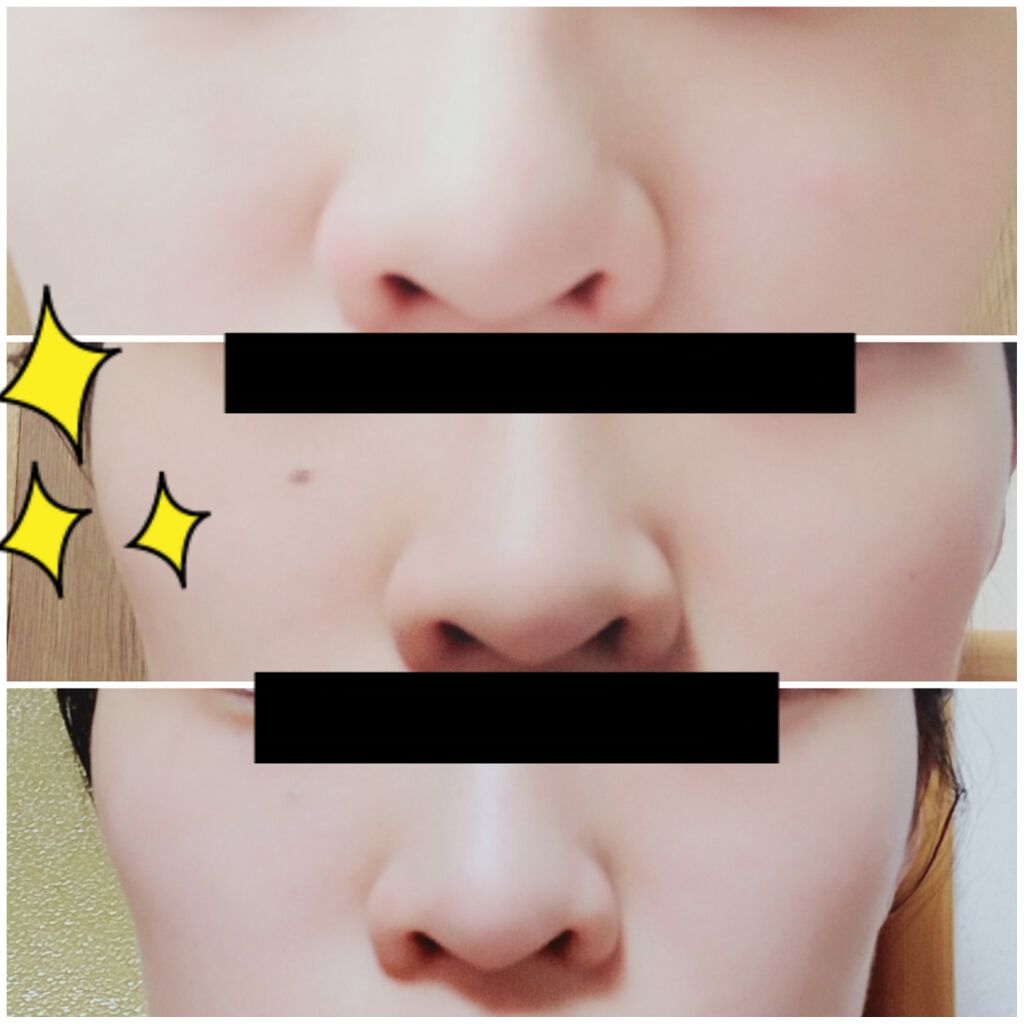 ノーズトレーナー/DAISO/その他スキンケアグッズを使ったクチコミ(3枚目)