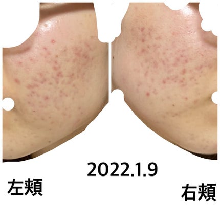 プロポリス エネルギーアンプル/CNP Laboratory/美容液を使ったクチコミ(1枚目)