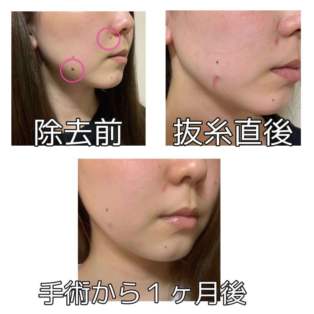 なずな on LIPS 「推しって精神安定剤だよね。わかる。皆様こんにちは、なずなです。..」(2枚目)