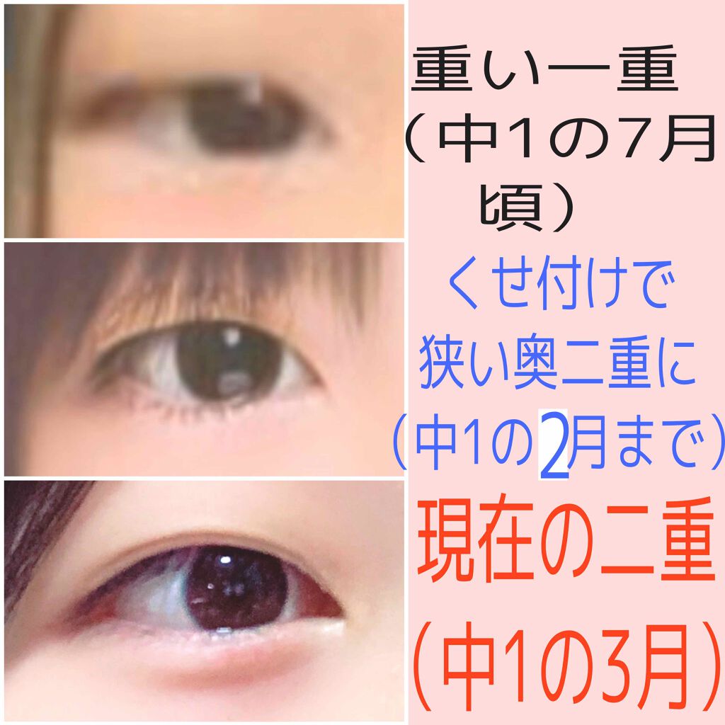 アイトーク/アイトーク/二重まぶた用アイテムを使ったクチコミ(2枚目)