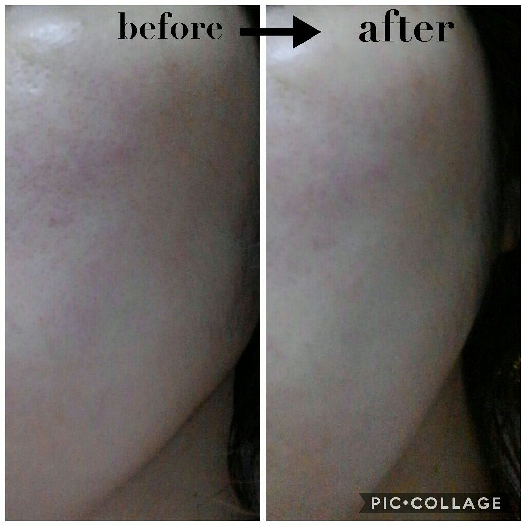 Ayulull Booster serum/Ayulull/美容液を使ったクチコミ（3枚目）