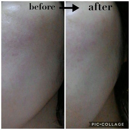 Ayulull Booster serum/Ayulull/美容液を使ったクチコミ(3枚目)