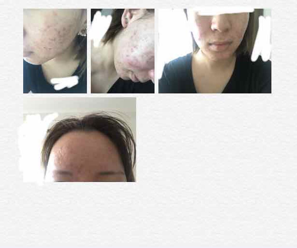 化粧水・敏感肌用・高保湿タイプ/無印良品/化粧水を使ったクチコミ(1枚目)