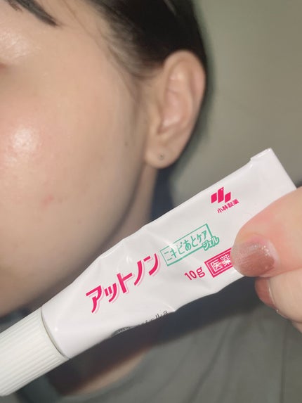 ニキビあとケアジェル/アットノン/その他スキンケアを使ったクチコミ(4枚目)