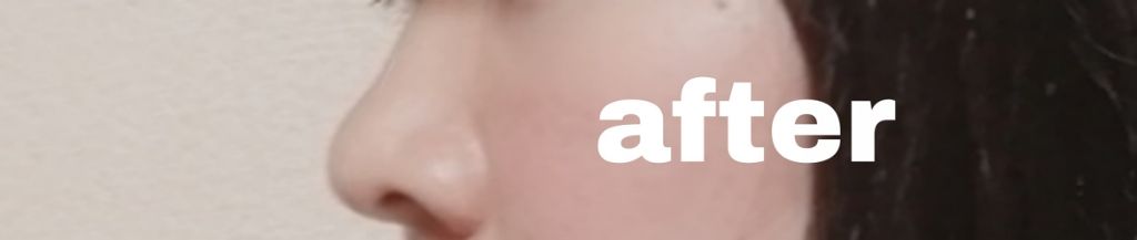 お鼻リフォーマー ハナハナ/グッズマン/その他を使ったクチコミ（2枚目）