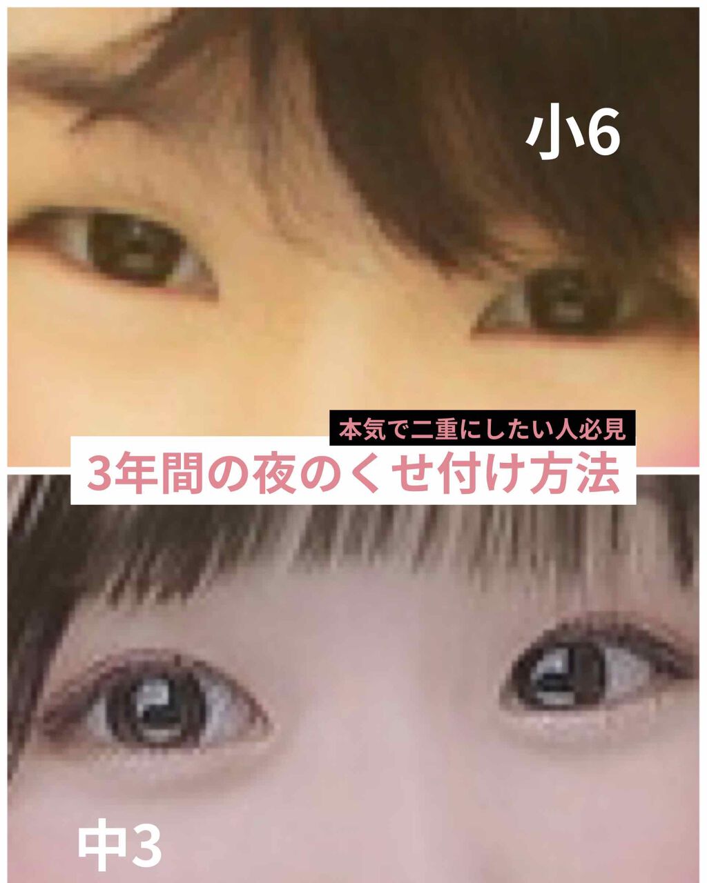 埋没式形成 くっきり二重テープ/DAISO/二重まぶた用アイテムを使ったクチコミ(1枚目)