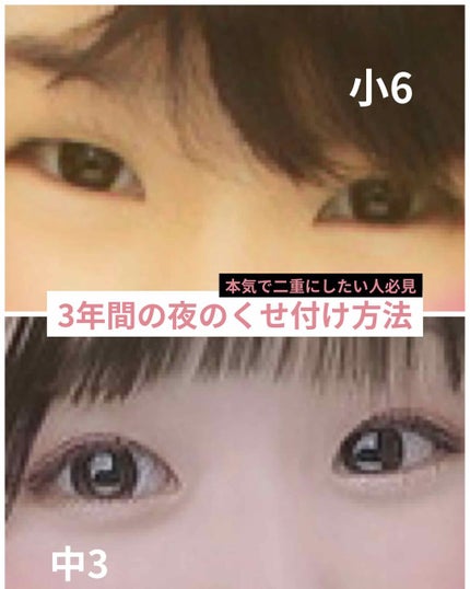 埋没式形成 くっきり二重テープ/DAISO/二重まぶた用アイテムを使ったクチコミ(1枚目)
