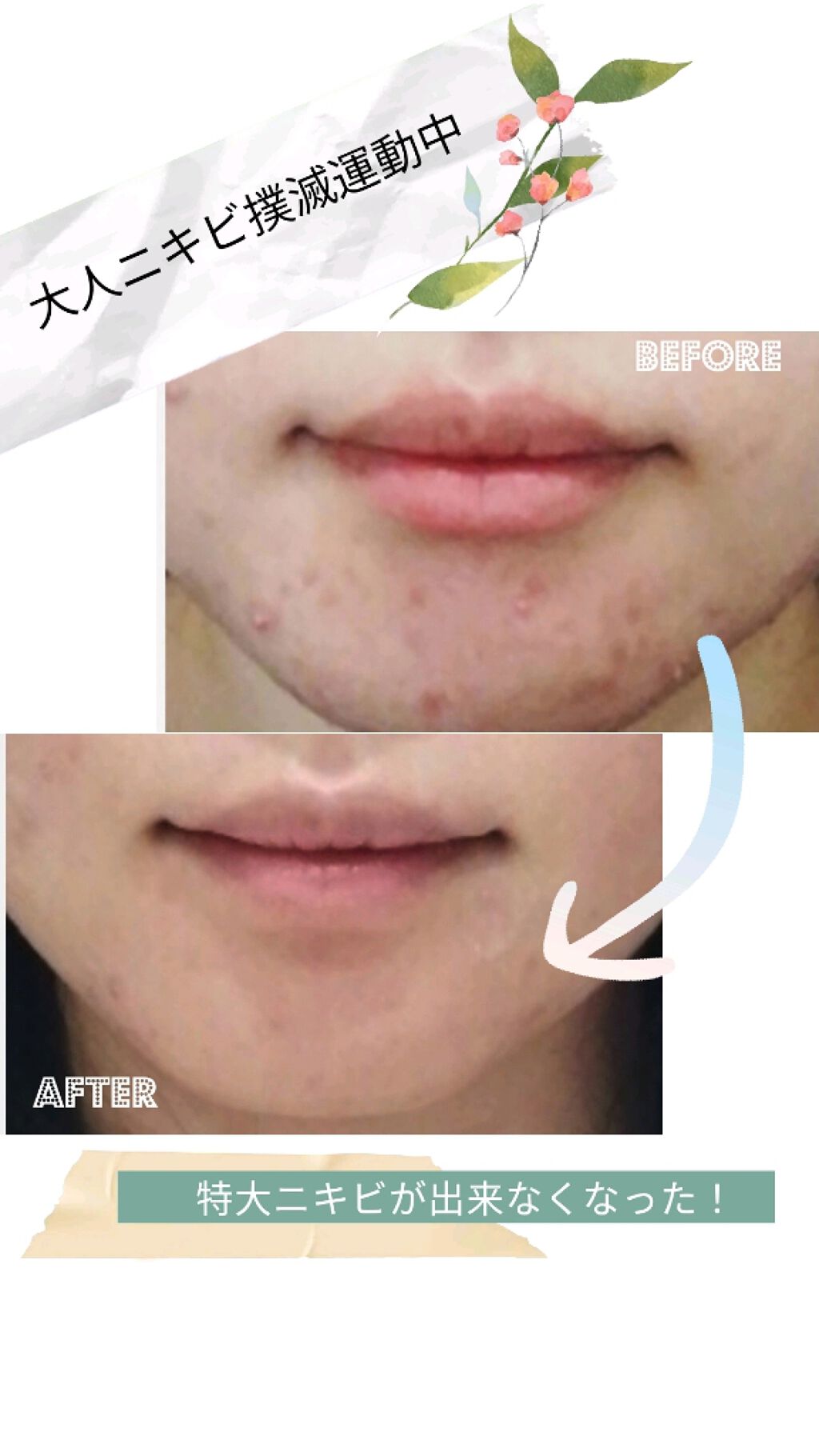 薬用 クリアローション M(しっとりタイプ)/オルビス/化粧水を使ったクチコミ（1枚目）