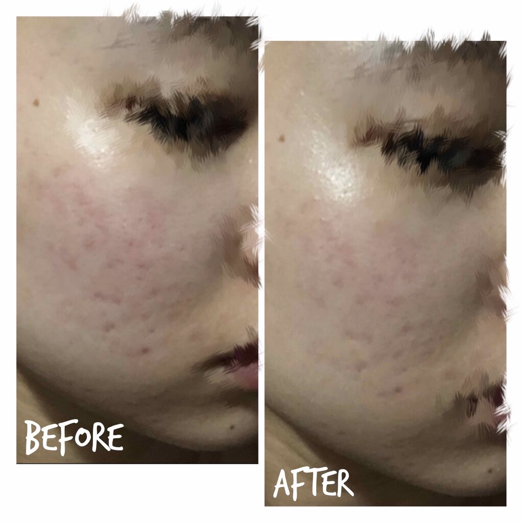 UVイデア XL プロテクションBB/ラ ロッシュ ポゼ/BBクリームを使ったクチコミ（3枚目）