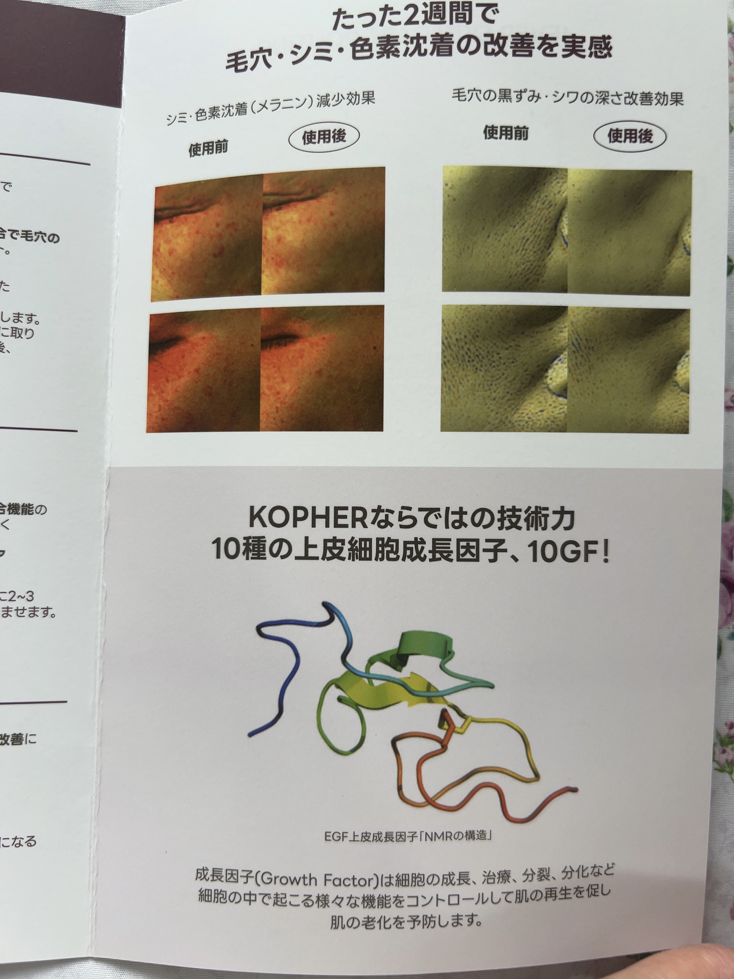 ソフィーナ iP ハリ弾力注入美容液/SOFINA iP/美容液を使ったクチコミ（2枚目）