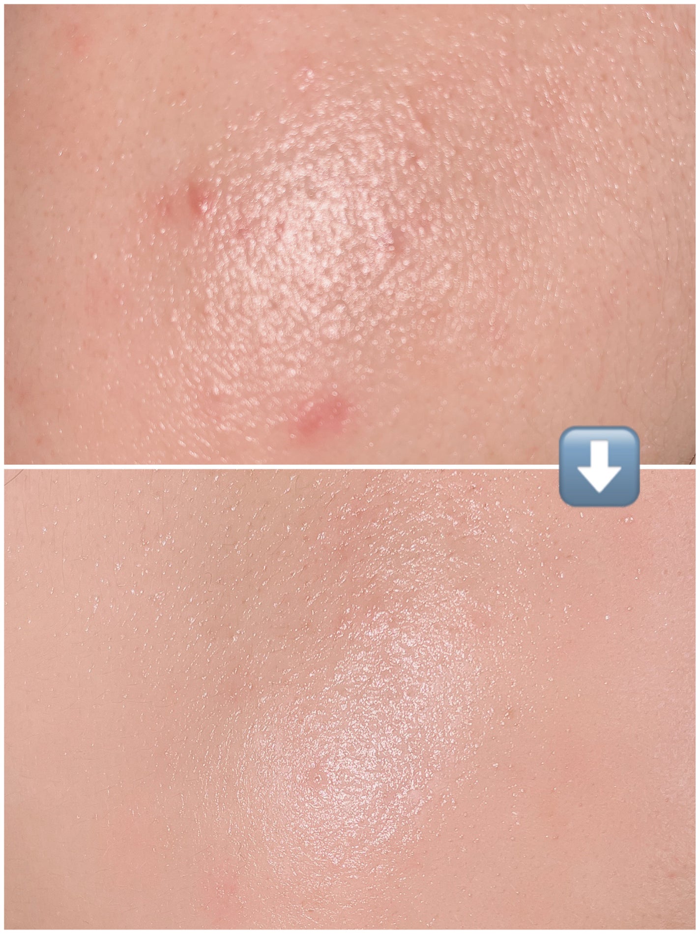 リードルショット300/VT/美容液を使ったクチコミ(4枚目)