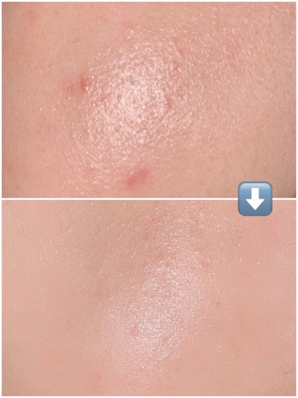 リードルショット300/VT/美容液を使ったクチコミ(4枚目)