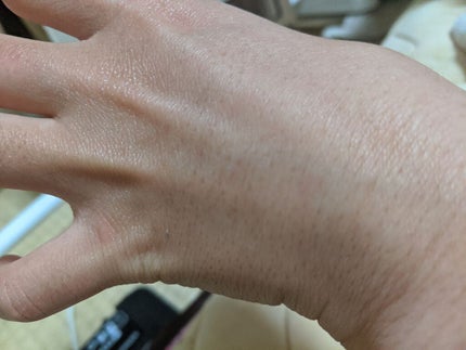 「間宮」アロエ軟膏 (医薬品)/アロエ製薬/その他を使ったクチコミ(3枚目)