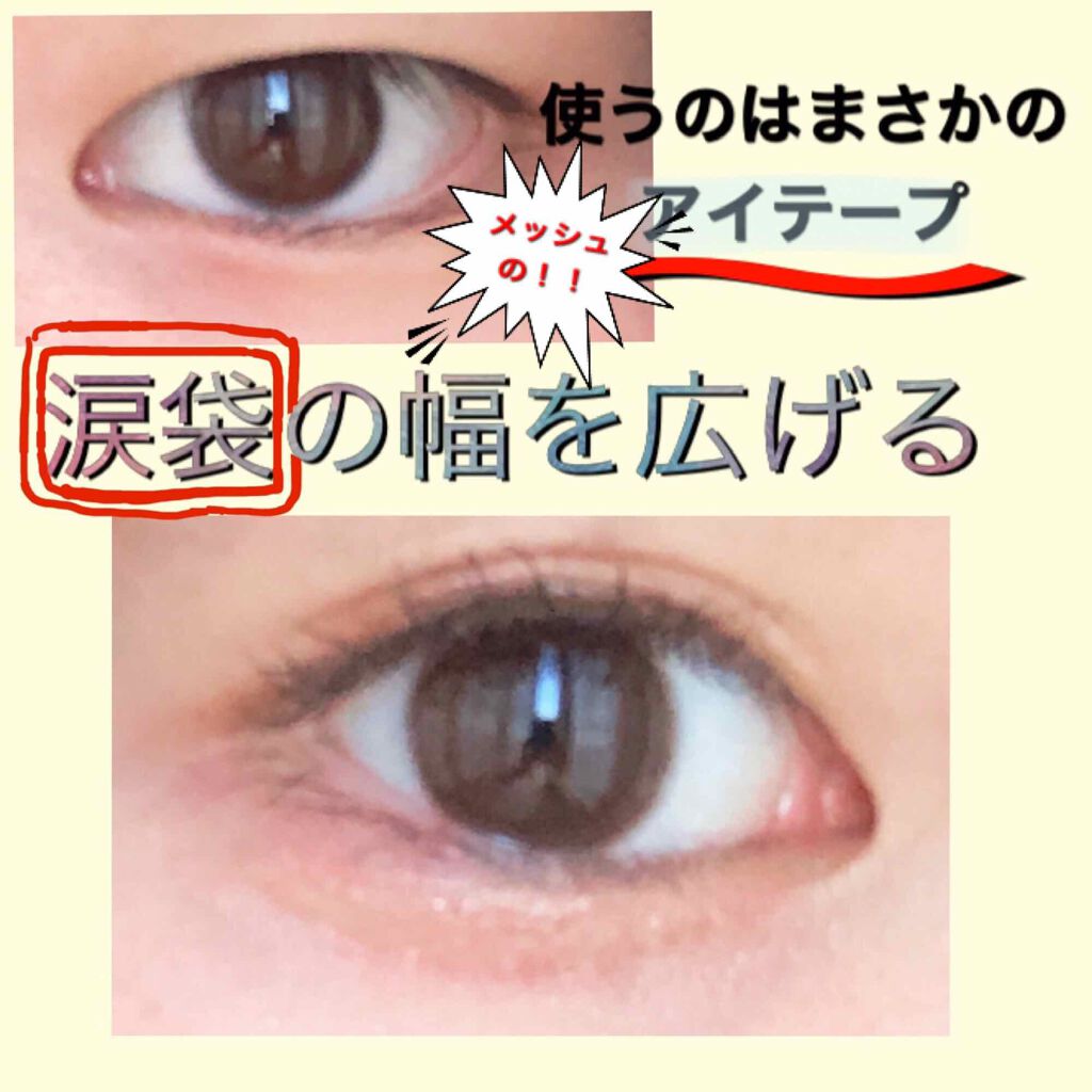 メッシュ アイテープ/shefun/二重まぶた用アイテムを使ったクチコミ（1枚目）