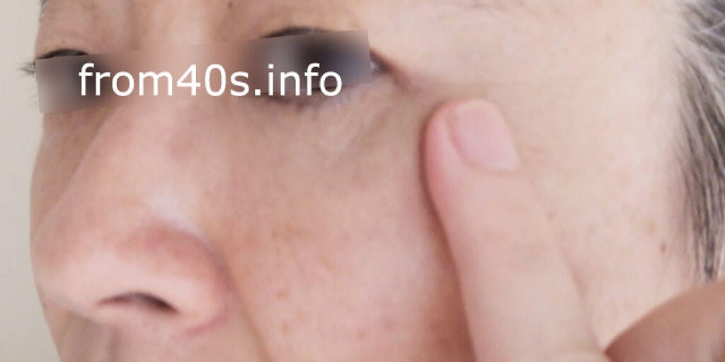 スキンカラーコントロール/ACSEINE/クリームコンシーラーを使ったクチコミ(4枚目)