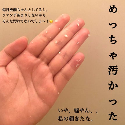 DETクリア ブライト&ピール ピーリングジェリー <ミックスベリーの香り>/Detclear/ピーリングを使ったクチコミ(4枚目)