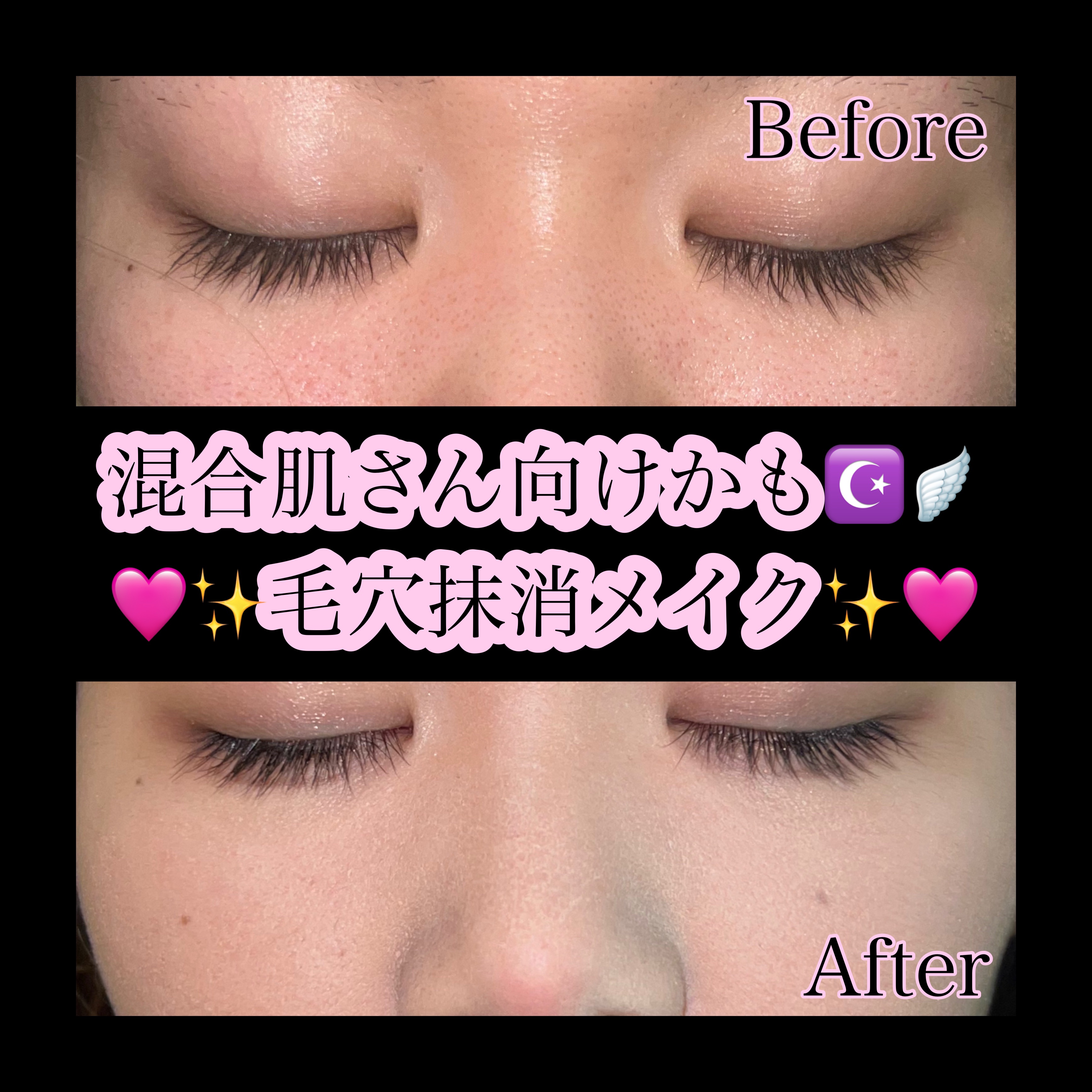 カラーミキシングコンシーラー/キャンメイク/パレットコンシーラーを使ったクチコミ（1枚目）