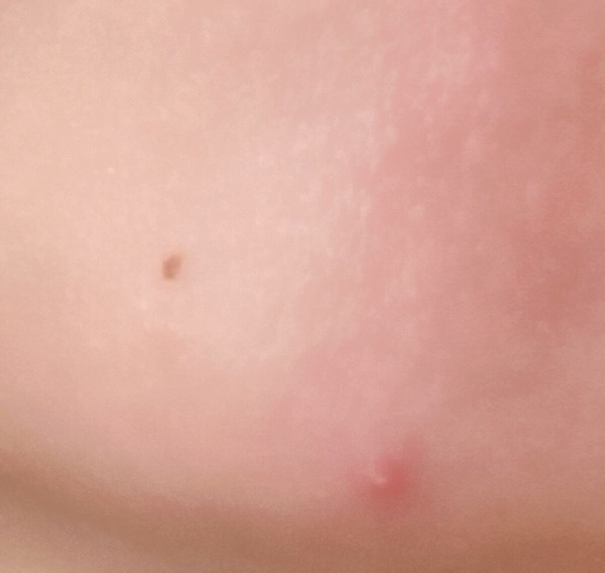 ミノン アミノモイスト 薬用マイルド ホワイトニング/ミノン/美容液を使ったクチコミ（2枚目）