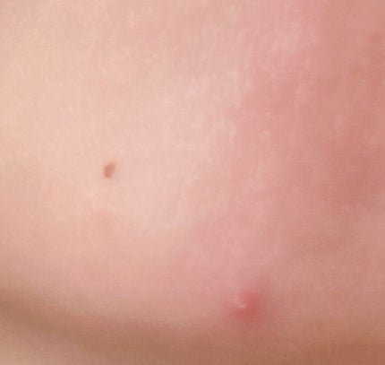 ホワイトアップ ローション(II)/アクアレーベル/化粧水を使ったクチコミ(2枚目)