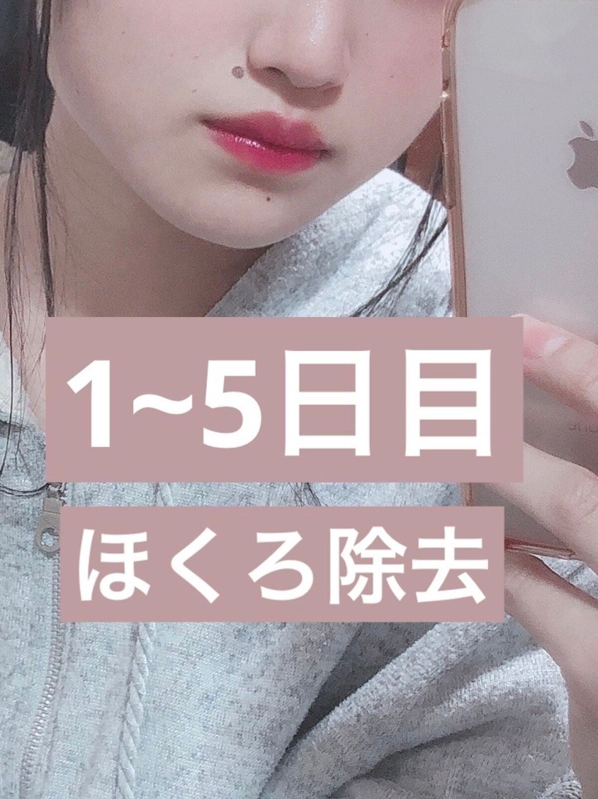 キズパワーパッド/バンドエイド/その他を使ったクチコミ(1枚目)