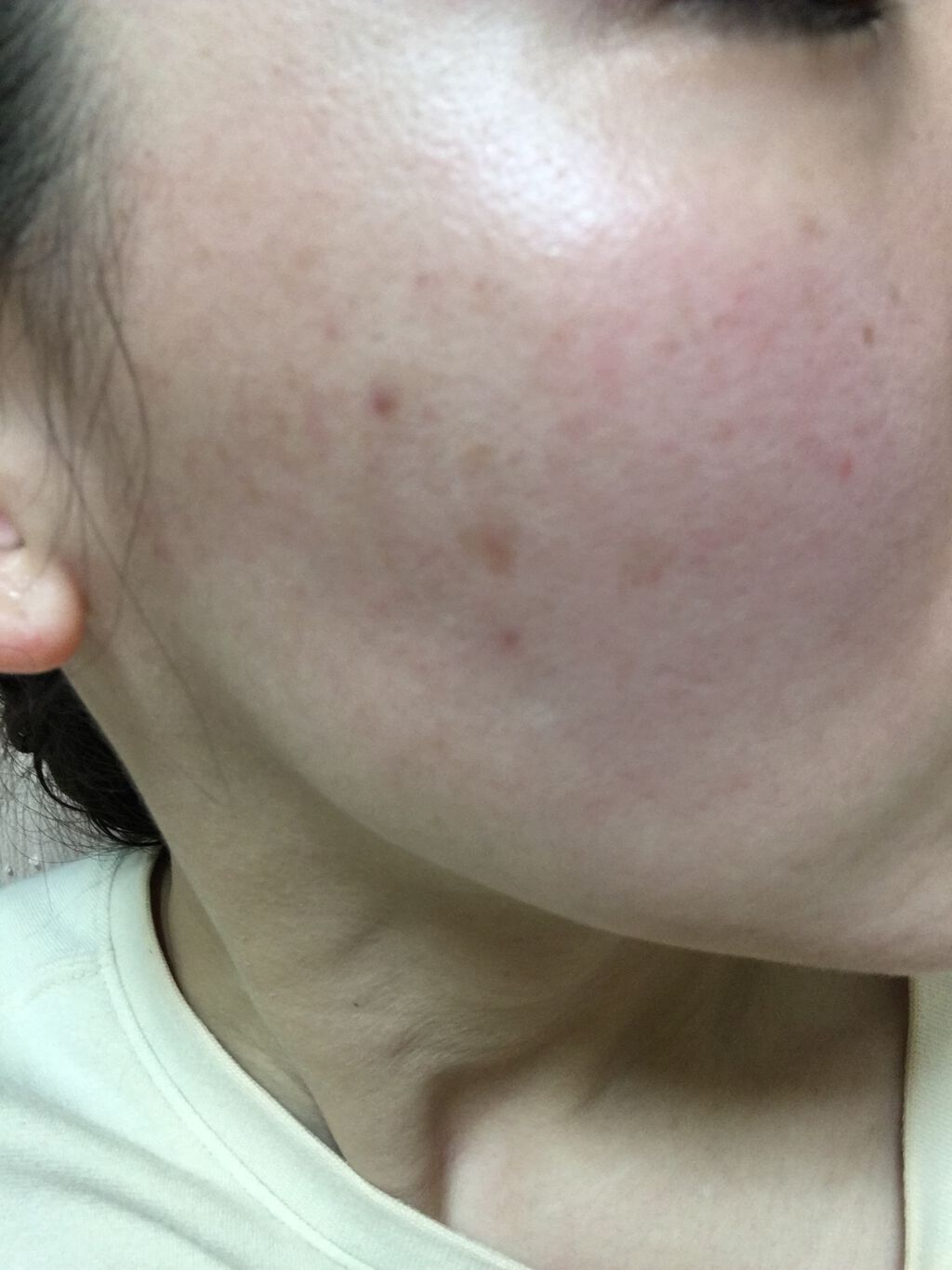 デイリーPD/ZO Skin Health/フェイスクリームを使ったクチコミ(1枚目)