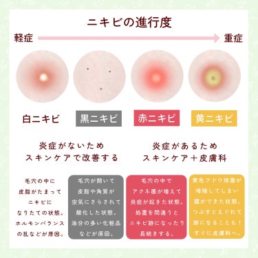 メラノCC 薬用しみ対策 美白化粧水のクチコミ「

　＼ ニキビのタイプ別ケアまとめ ／


　ニキビは「色」によって

　合うスキンケアや対.....」（2枚目）