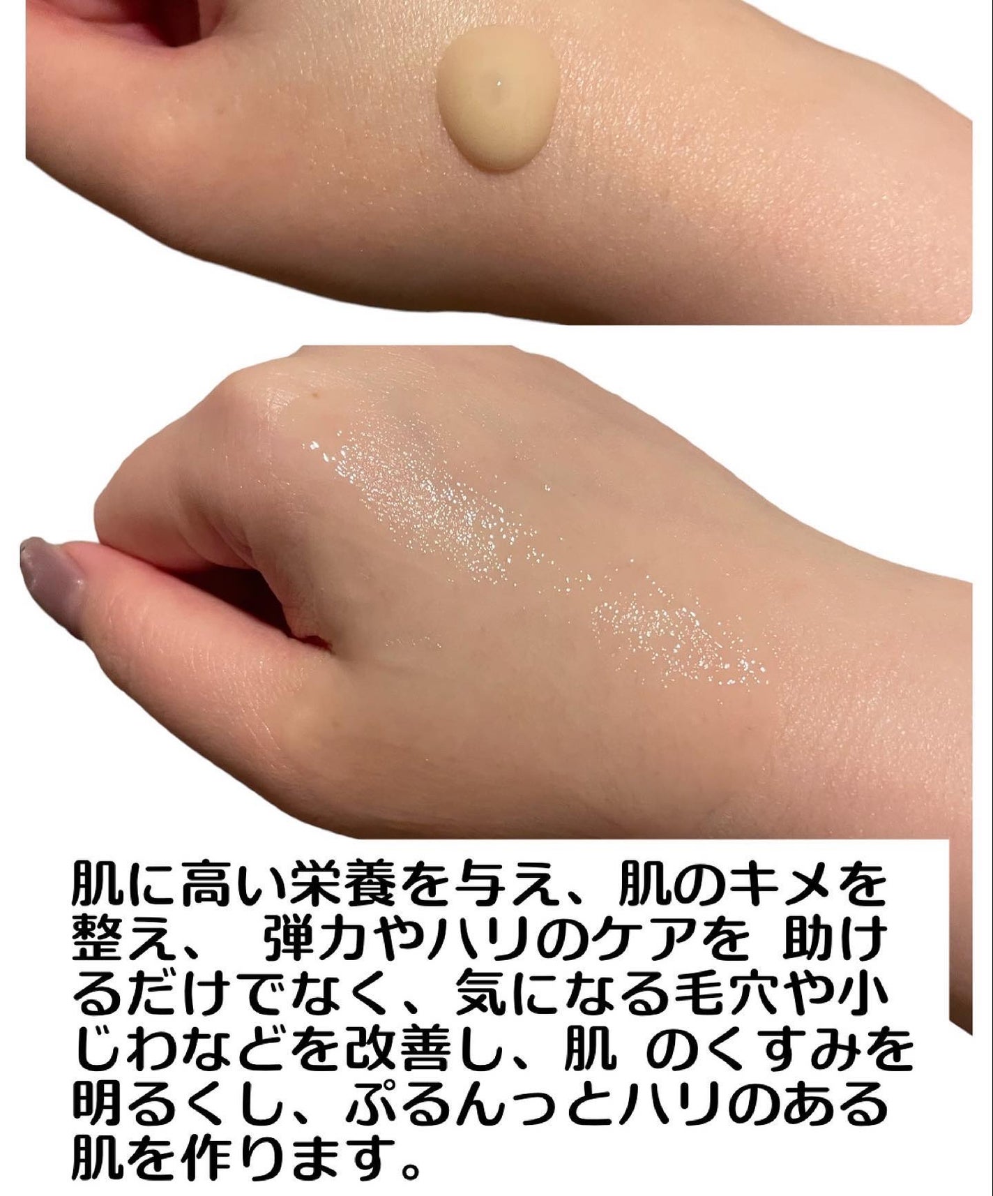 ブラックスネイルレチノールセラム/Dr.G/美容液を使ったクチコミ(4枚目)