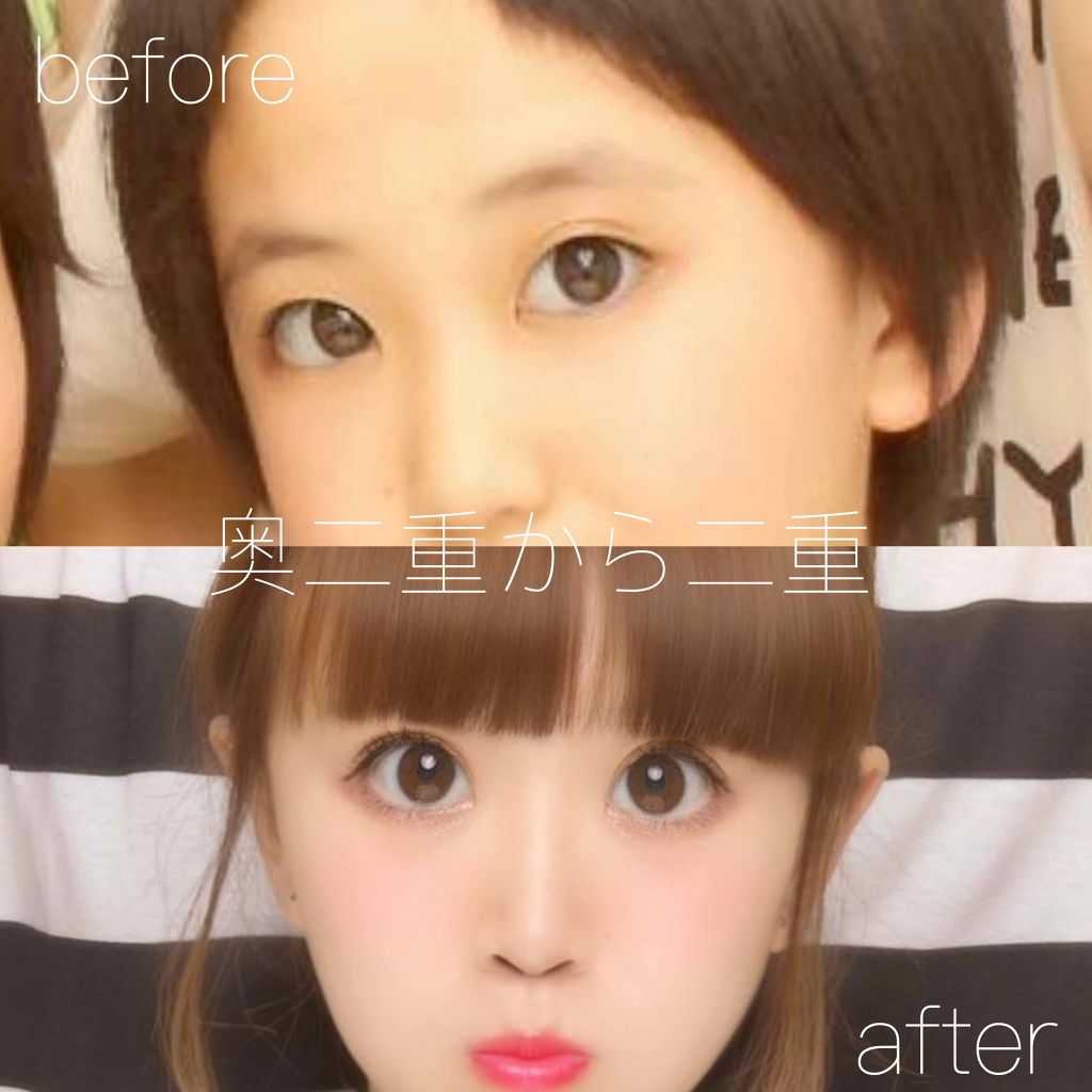 ここ on LIPS 「一重、奥二重必見👁!!早くこのマッサージすれば良かった、と後悔..」(1枚目)