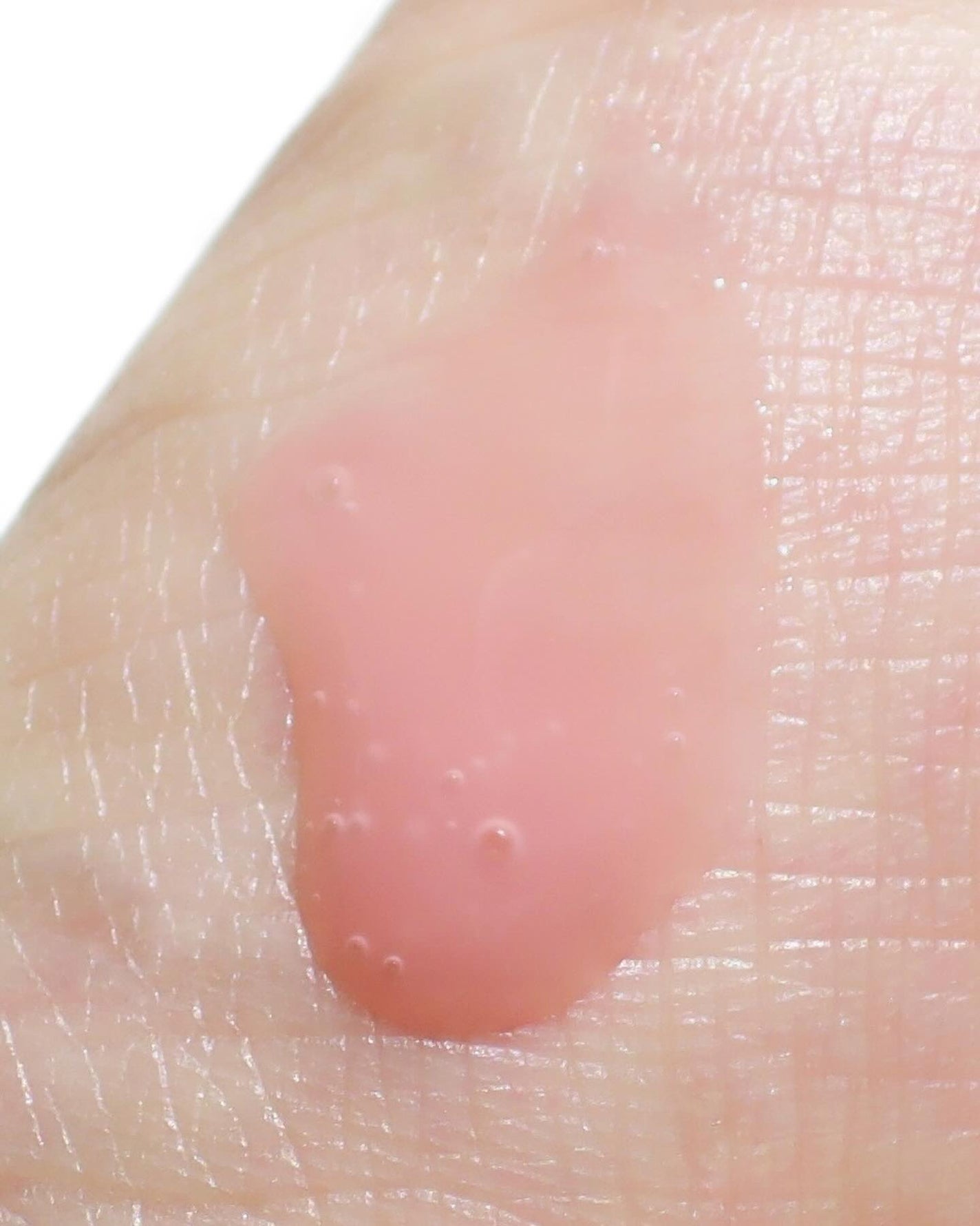 PDRNピンクアンプル PDRN 10,000ppm配合/MEDICUBE/美容液を使ったクチコミ(4枚目)