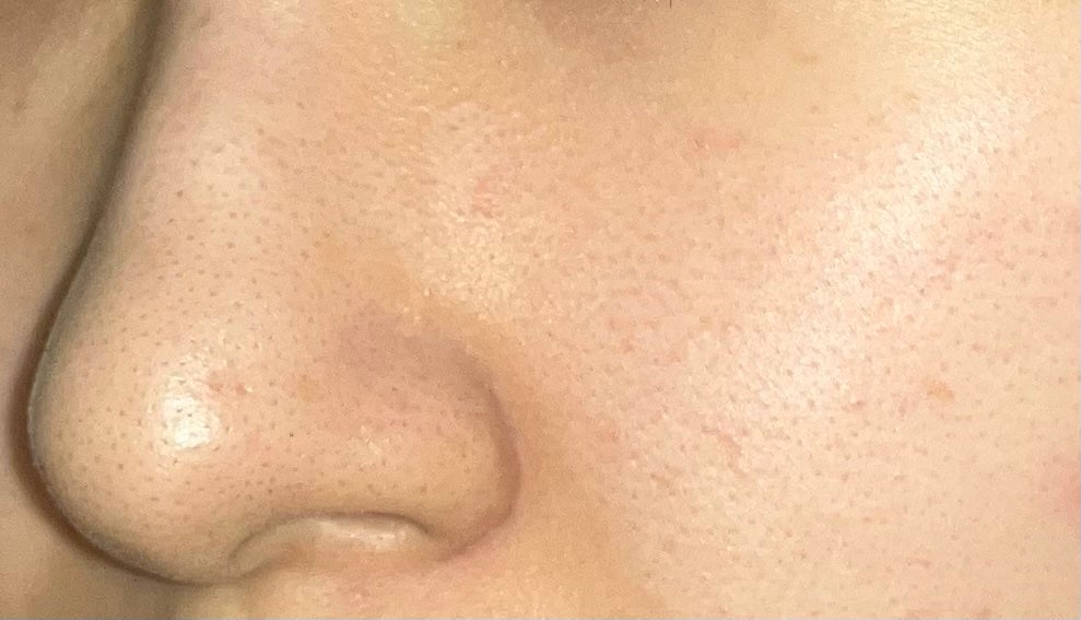 ノーモアブラックヘッド(ノーズピーリング)/One-day's you/スクラブ・ゴマージュを使ったクチコミ(7枚目)