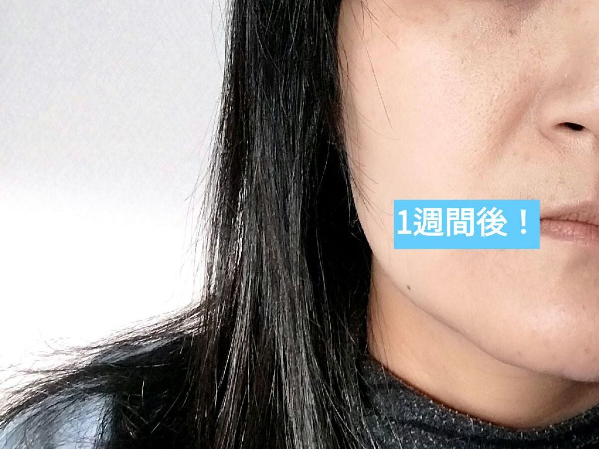 バイオ コンディショニング エッセンス/IOPE/ブースター・導入液を使ったクチコミ(6枚目)