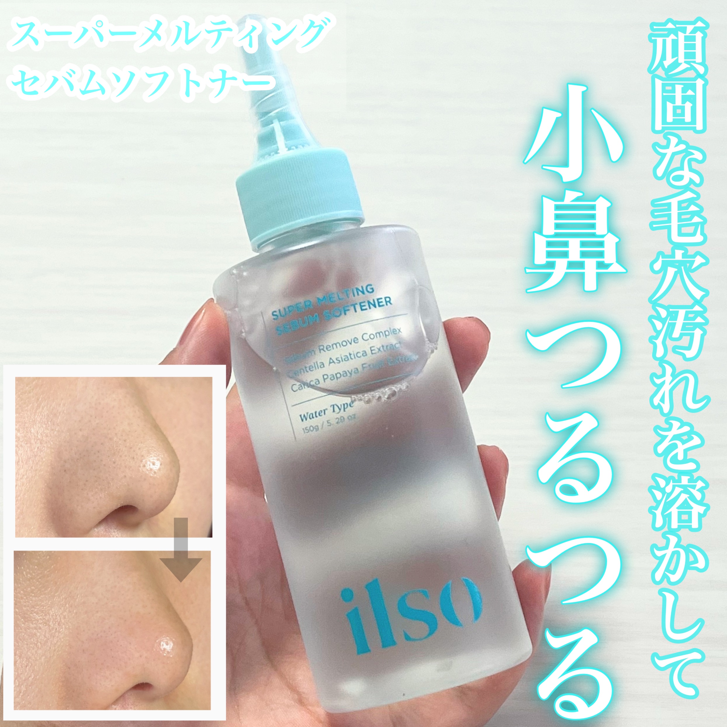 ILSO　スーパーメルティング セバムソフトナー/ilso/化粧水を使ったクチコミ（1枚目）