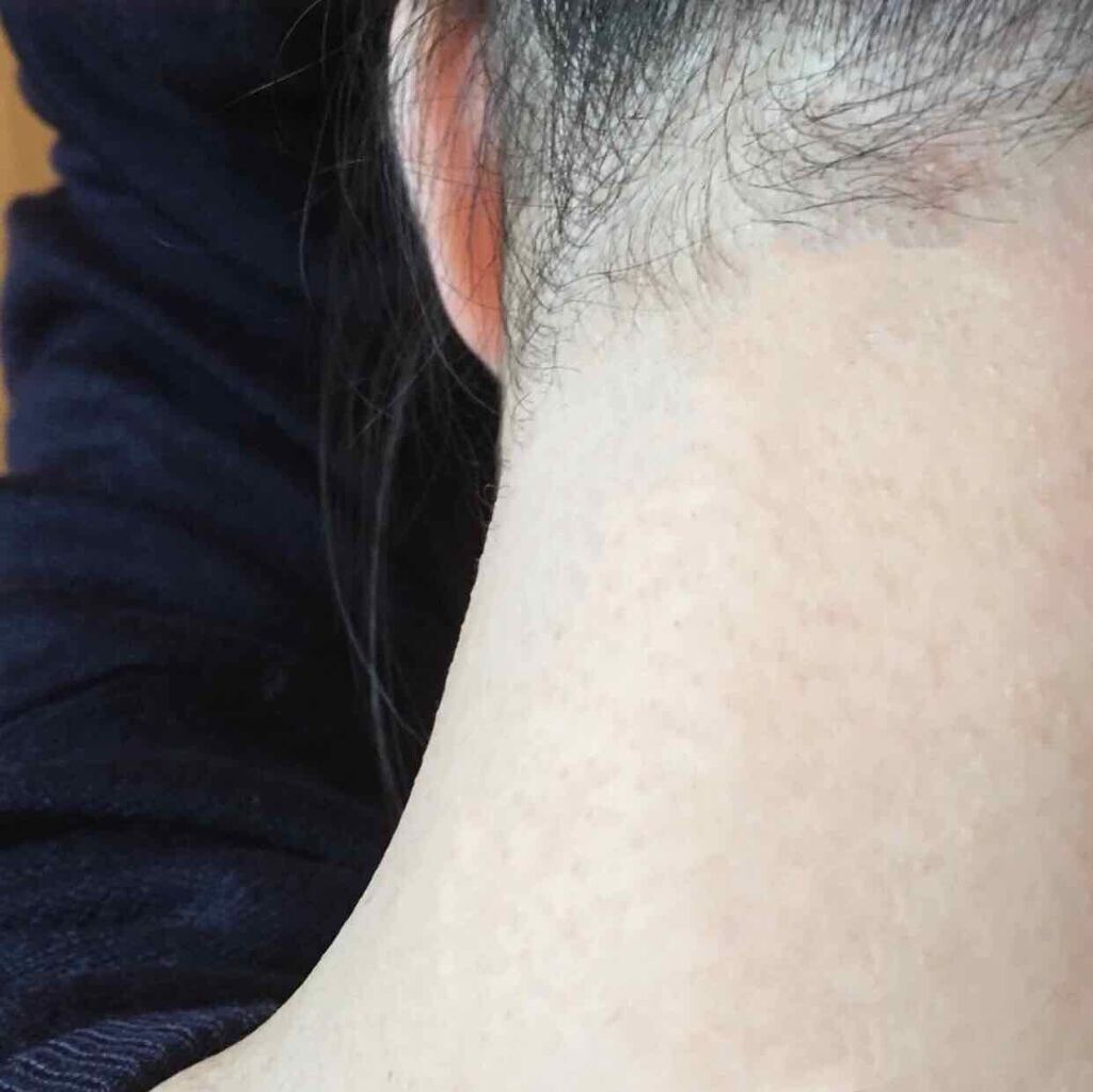 脱毛ワックスシート 敏感肌用/Veet/除毛クリームを使ったクチコミ（3枚目）