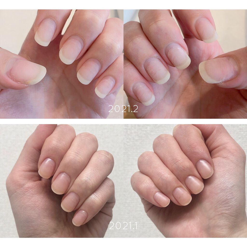 ユースキン/ユースキン/ボディクリームを使ったクチコミ（2枚目）